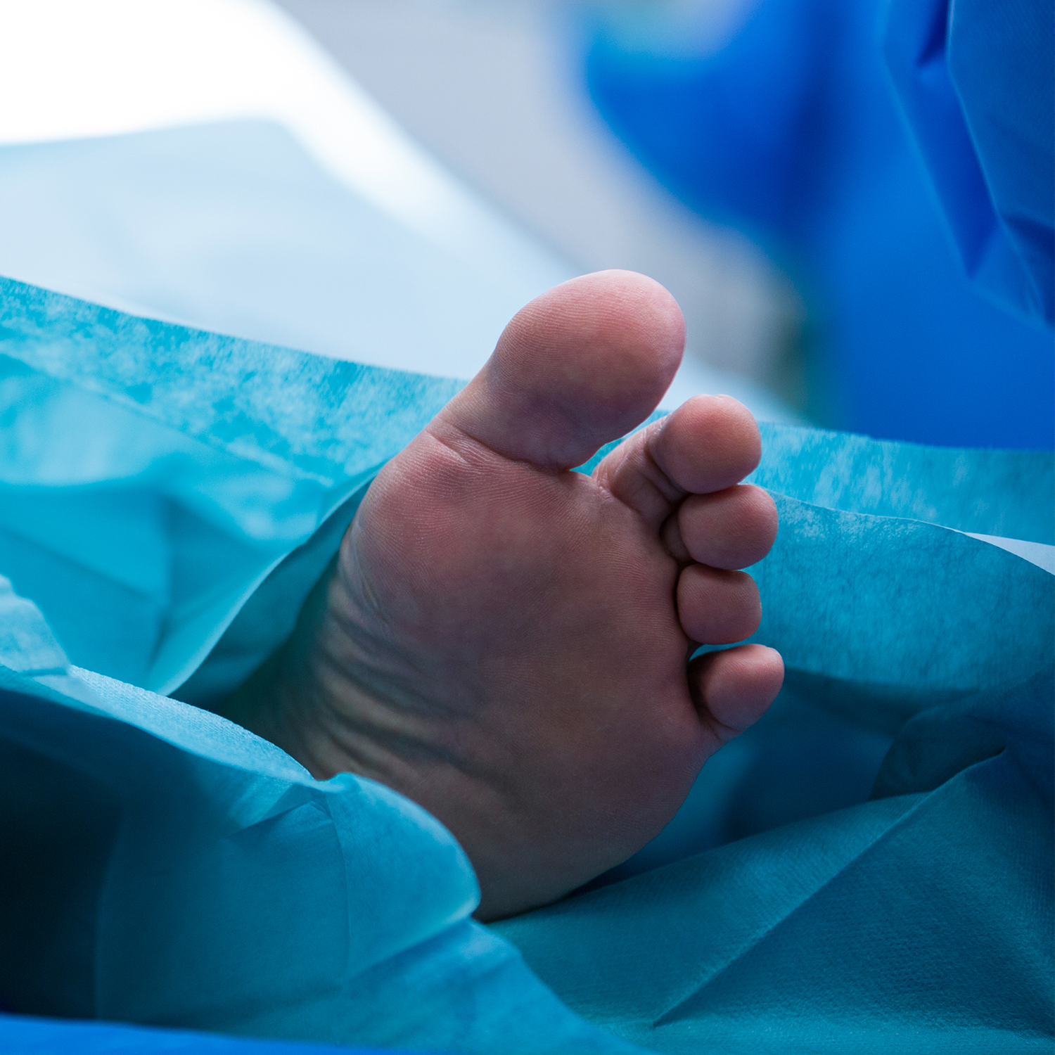 Cirugía de hallux valgus (juanete)